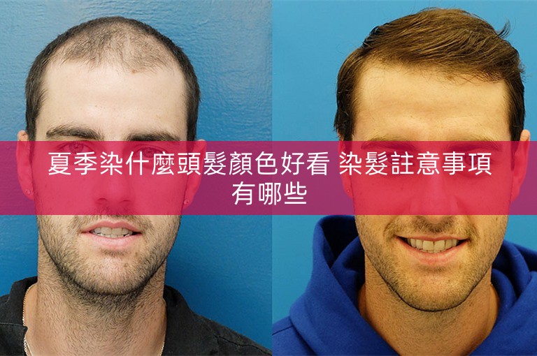 夏季染什麼頭髮顏色好看 染髮註意事項有哪些