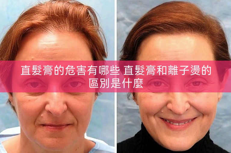 直髮膏的危害有哪些 直髮膏和離子燙的區別是什麼