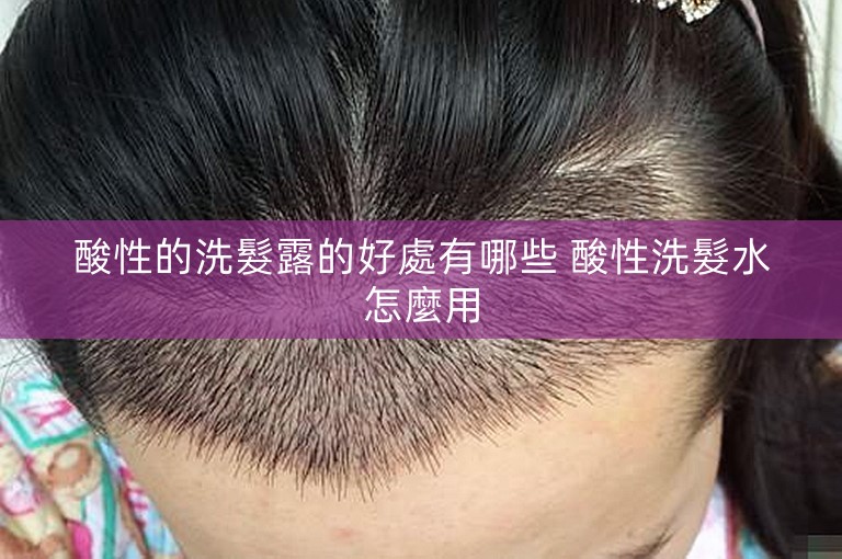 酸性的洗髮露的好處有哪些 酸性洗髮水怎麼用