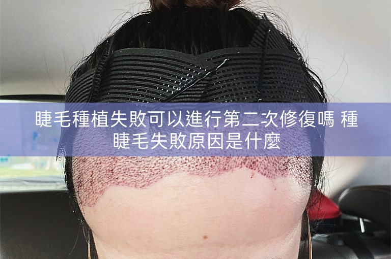 睫毛種植失敗可以進行第二次修復嗎 種睫毛失敗原因是什麼 睫毛種植失敗可以進行第二次修復嗎 種睫毛失敗原因是什麼