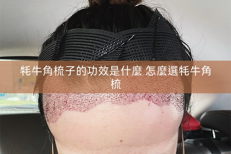 牦牛角梳子的功效是什麼 怎麼選牦牛角梳