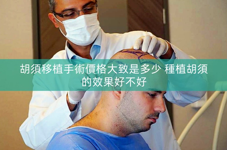 胡須移植手術價格大致是多少 種植胡須的效果好不好