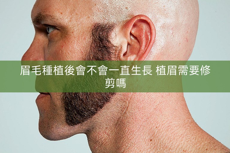 眉毛種植後會不會一直生長 植眉需要修剪嗎