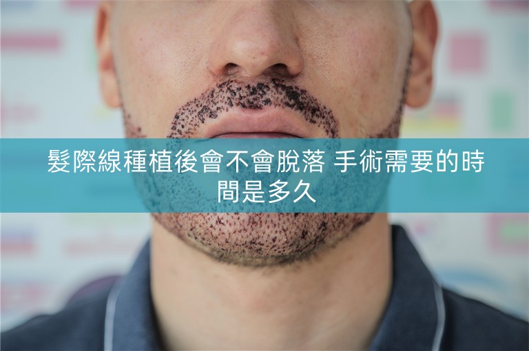 髮際線種植後會不會脫落 手術需要的時間是多久