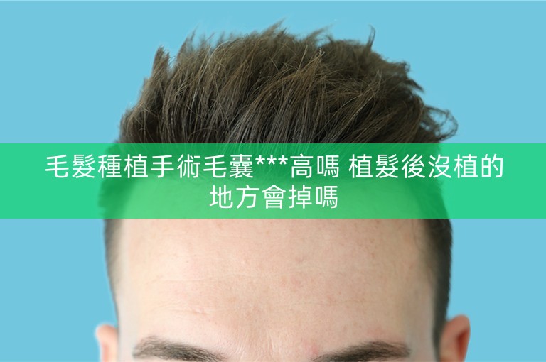 毛髮種植手術毛囊***高嗎 植髮後沒植的地方會掉嗎