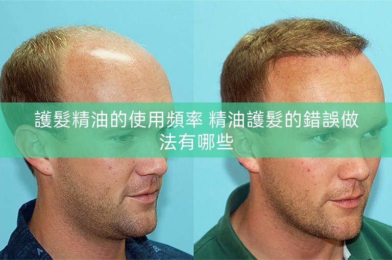 護髮精油的使用頻率 精油護髮的錯誤做法有哪些