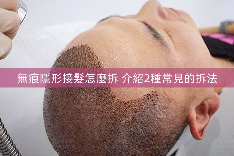 無痕隱形接髮怎麼拆 介紹2種常見的拆法