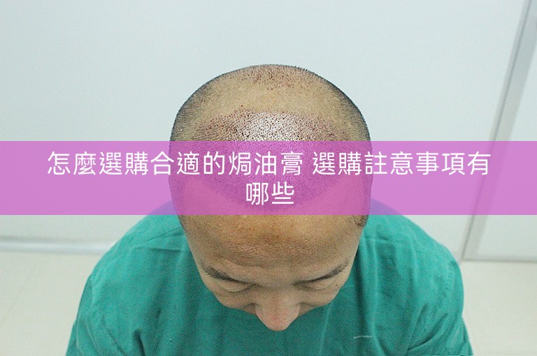 怎麼選購合適的焗油膏 選購註意事項有哪些