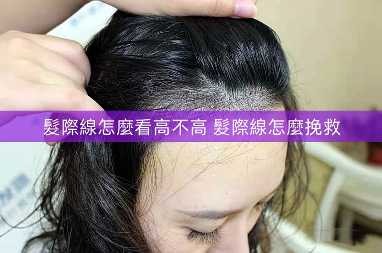 髮際線怎麼看高不高 髮際線怎麼挽救