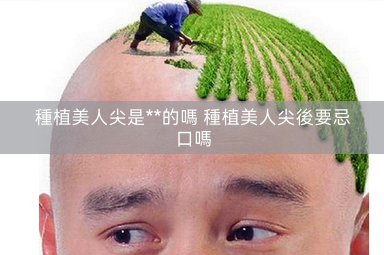 種植美人尖是**的嗎 種植美人尖後要忌口嗎 種植美人尖是**的嗎 種植美人尖後要忌口嗎