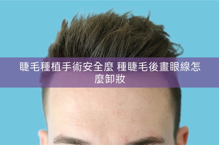 睫毛種植手術安全麼 種睫毛後畫眼線怎麼卸妝