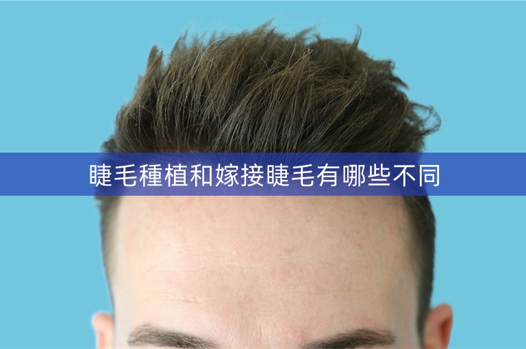 睫毛種植和嫁接睫毛有哪些不同