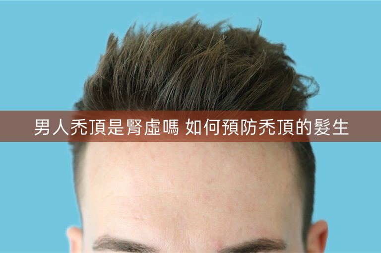 男人禿頂是腎虛嗎 如何預防禿頂的髮生