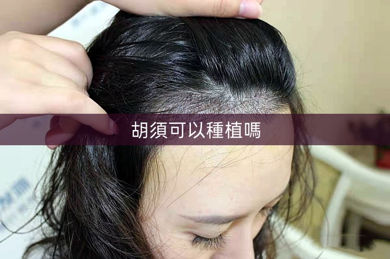 胡須可以種植嗎 胡須可以種植嗎