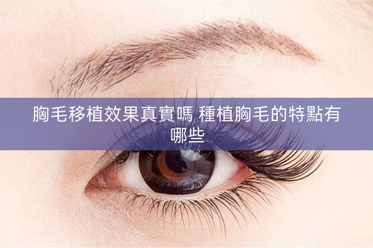 胸毛移植效果真實嗎 種植胸毛的特點有哪些 胸毛移植效果真實嗎 種植胸毛的特點有哪些