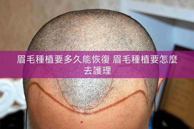 眉毛種植要多久能恢復 眉毛種植要怎麼去護理