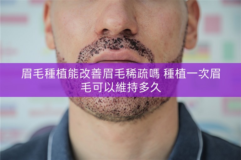 眉毛種植能改善眉毛稀疏嗎 種植一次眉毛可以維持多久