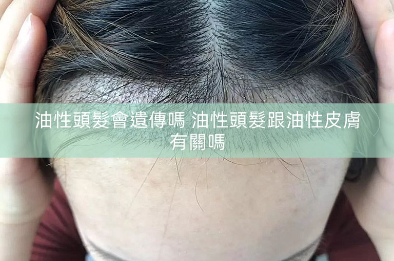 油性頭髮會遺傳嗎 油性頭髮跟油性皮膚有關嗎