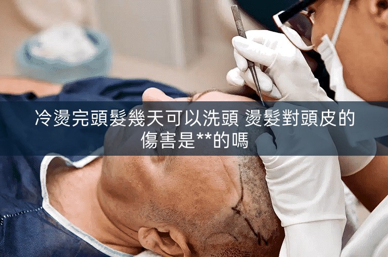 冷燙完頭髮幾天可以洗頭 燙髮對頭皮的傷害是**的嗎
