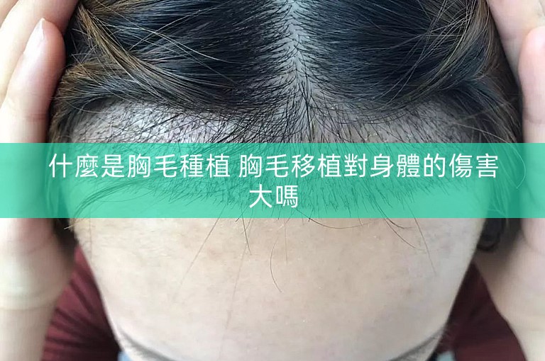 什麼是胸毛種植 胸毛移植對身體的傷害大嗎 什麼是胸毛種植 胸毛移植對身體的傷害大嗎
