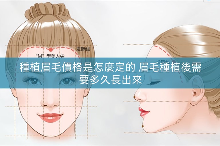 種植眉毛價格是怎麼定的 眉毛種植後需要多久長出來