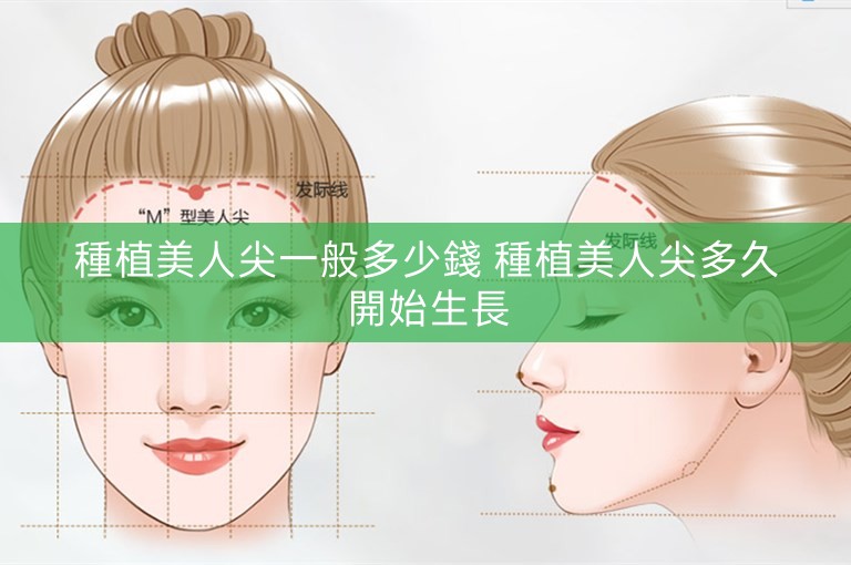 種植美人尖一般多少錢 種植美人尖多久開始生長