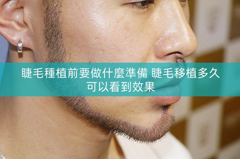 睫毛種植前要做什麼準備 睫毛移植多久可以看到效果