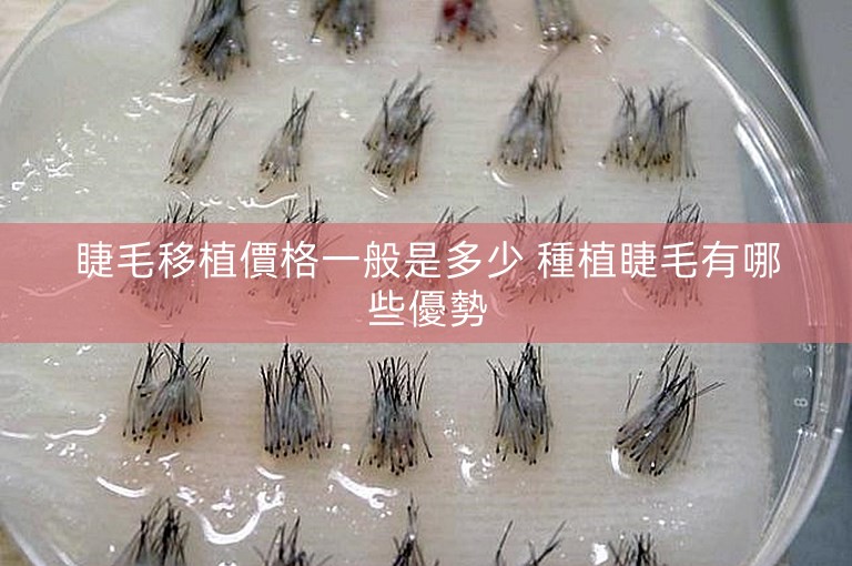 睫毛移植價格一般是多少 種植睫毛有哪些優勢