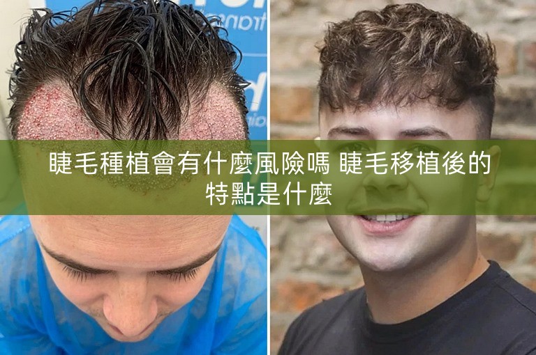 睫毛種植會有什麼風險嗎 睫毛移植後的特點是什麼