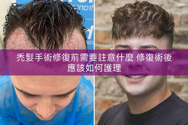 禿髮手術修復前需要註意什麼 修復術後應該如何護理
