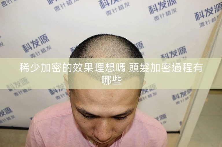 稀少加密的效果理想嗎 頭髮加密過程有哪些