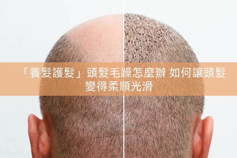 「養髮護髮」頭髮毛躁怎麼辦 如何讓頭髮變得柔順光滑 「養髮護髮」頭髮毛躁怎麼辦 如何讓頭髮變得柔順光滑