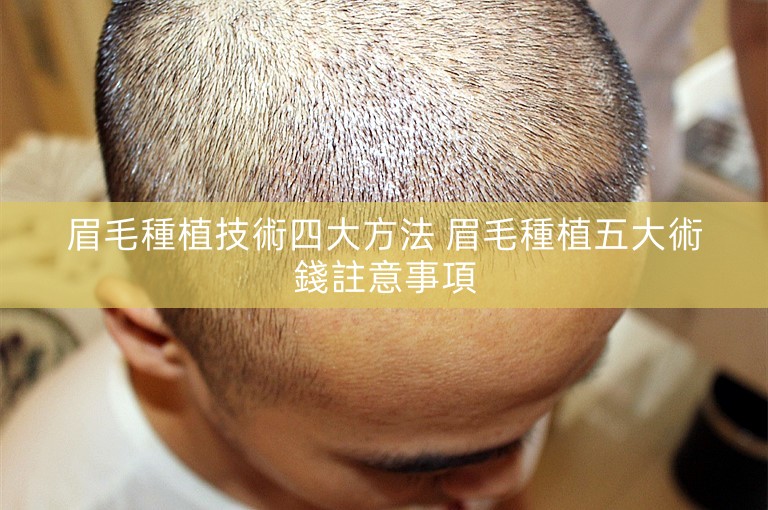 眉毛種植技術四大方法 眉毛種植五大術錢註意事項